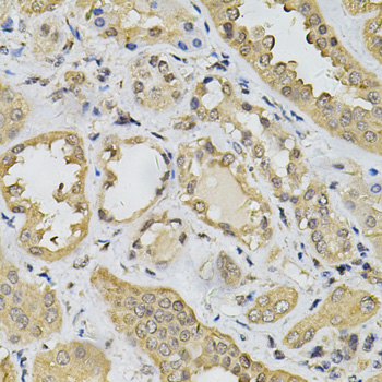 Immunohistochemistry - N6AMT1 Polyclonal Antibody 