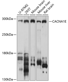 Western blot - CACNA1E Polyclonal Antibody 