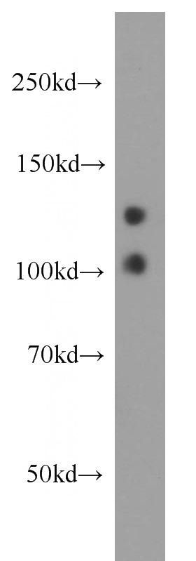 human brain tissue were subjected to SDS PAGE followed by western blot with Catalog No:112978(MYO16 antibody) at dilution of 1:500