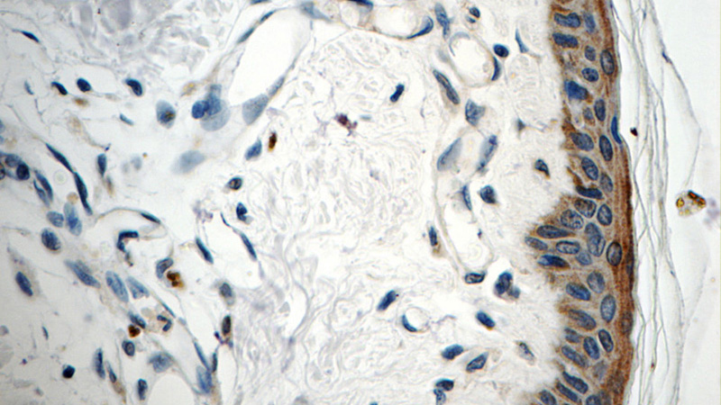 Immunohistochemistry of paraffin-embedded human skin tissue slide using Catalog No:115643(SPRR1B Antibody) at dilution of 1:50 (under 40x lens)
