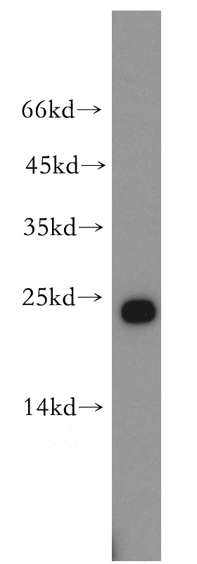 PC-3 cells were subjected to SDS PAGE followed by western blot with Catalog No:111384(HDDC2 antibody) at dilution of 1:1500