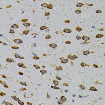 Immunohistochemistry - CAPRIN1 Polyclonal Antibody 
