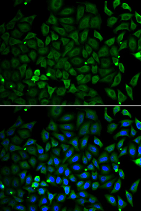 Immunofluorescence - Parkin Polyclonal Antibody 