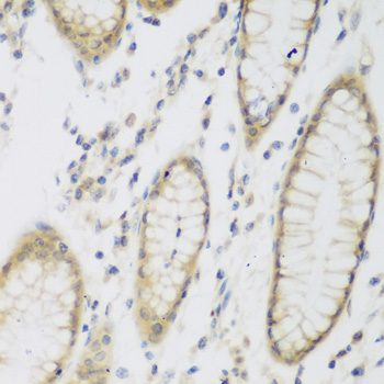 Immunohistochemistry - NAT8B Polyclonal Antibody 