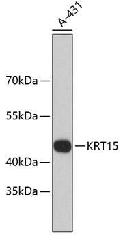 Western blot - KRT15 Monoclonal Antibody 