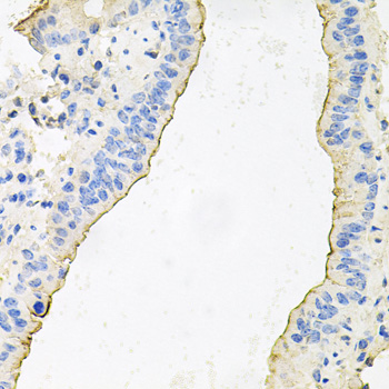 Immunohistochemistry - HPR Polyclonal Antibody 