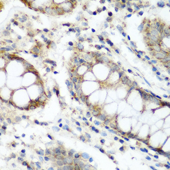 Immunohistochemistry - NAA60 Polyclonal Antibody 