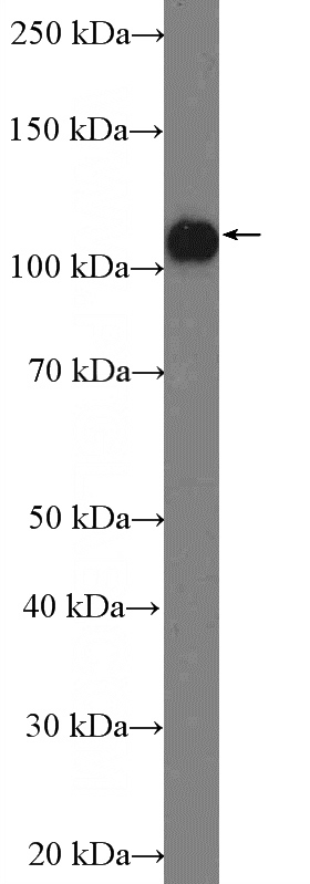 HeLa cells were subjected to SDS PAGE followed by western blot with Catalog No:108062(ANKLE2 Antibody) at dilution of 1:1000