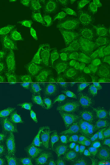 Immunofluorescence - AANAT Polyclonal Antibody 