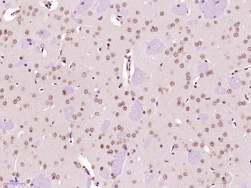 Fig5: Paraformaldehyde-fixed, paraffin embedded (Mouse brain); Antigen retrieval by boiling in sodium citrate buffer (pH6.0) for 15min; Block endogenous peroxidase by 3% hydrogen peroxide for 20 minutes; Blocking buffer (normal goat serum) at 37℃ for 30min; Antibody incubation with (UNCX) Polyclonal Antibody, Unconjugated at 1:400 overnight at 4℃, followed by operating according to SP Kit(Rabbit) (sp-0023) instructionsand DAB staining.