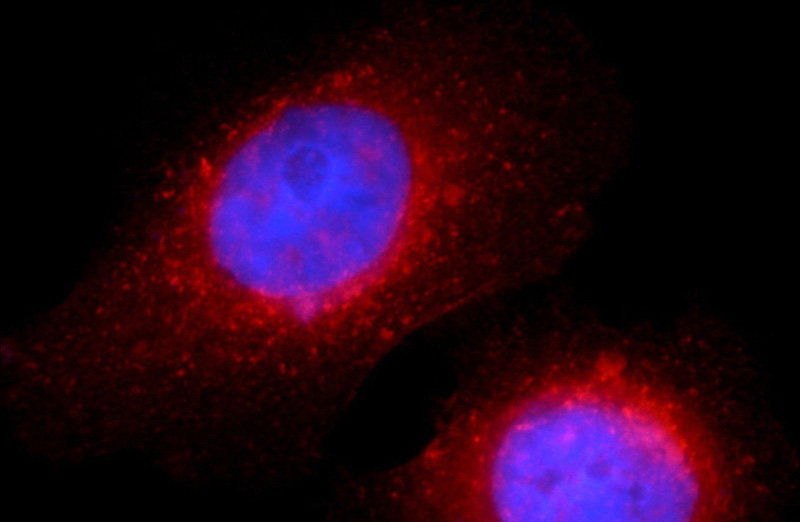 Immunofluorescent analysis of HeLa cells using Catalog No:107143(CD71 Antibody) at dilution of 1:50 and Rhodamine-Goat anti-Mouse IgG