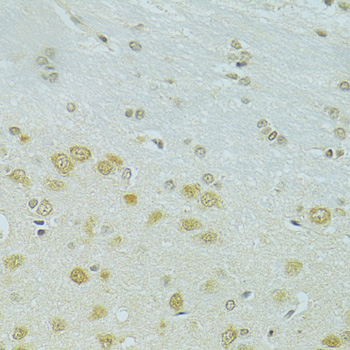 Immunohistochemistry - RSRC1 Polyclonal Antibody 