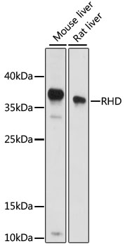 Western blot - RHD Polyclonal Antibody 