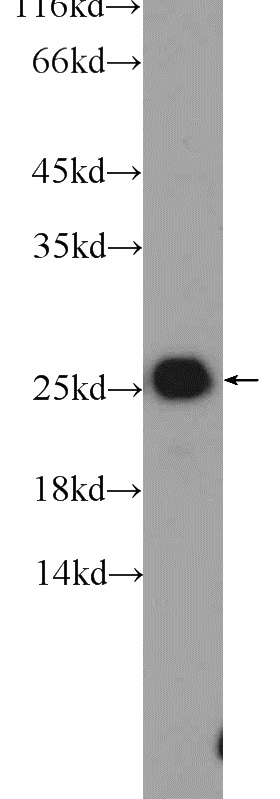 HeLa cells were subjected to SDS PAGE followed by western blot with Catalog No:115990(TAF9 Antibody) at dilution of 1:1000