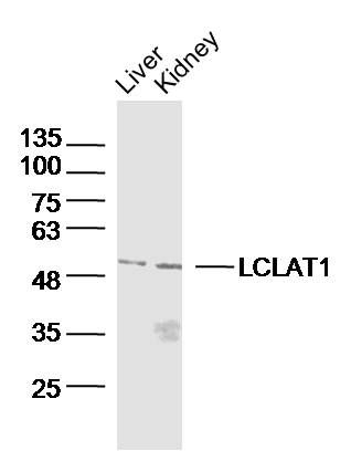 Fig2: Sample:; Liver(Mouse)Lysate at 40 ug; Kidney (Mouse)Lysate at 40 ug; Primary: Anti-LCLAT1 at 1/300 dilution; Secondary: IRDye800CW Goat Anti-RabbitIgG at 1/20000 dilution; Predicted band size: 49kD; Observed band size: 49kD