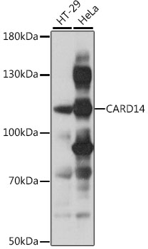 Western blot - CARD14 Polyclonal Antibody 