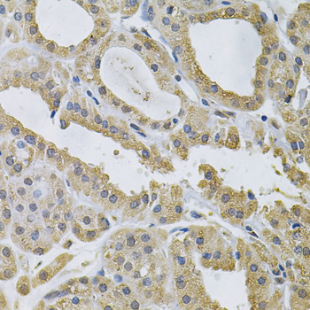Immunohistochemistry - NCF4 Polyclonal Antibody 