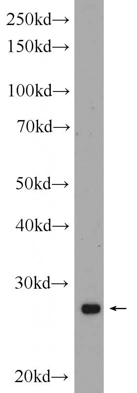 rat heart tissue were subjected to SDS PAGE followed by western blot with Catalog No:111401(HELT Antibody) at dilution of 1:1000
