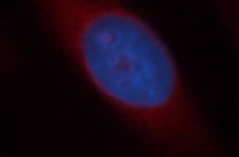 Immunofluorescent analysis of Hela cells, using KLC1 antibody Catalog No:112073 at 1:25 dilution and Rhodamine-labeled goat anti-rabbit IgG (red). Blue pseudocolor = DAPI (fluorescent DNA dye).