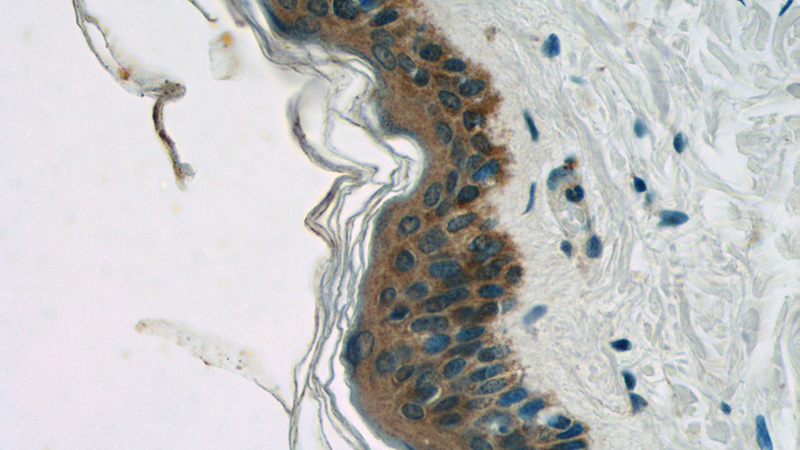 Immunohistochemistry of paraffin-embedded human skin tissue slide using Catalog No:109709(CYP4F8 Antibody) at dilution of 1:50 (under 40x lens)