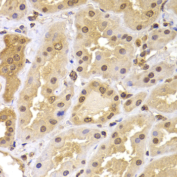 Immunohistochemistry - PHF21B Polyclonal Antibody 
