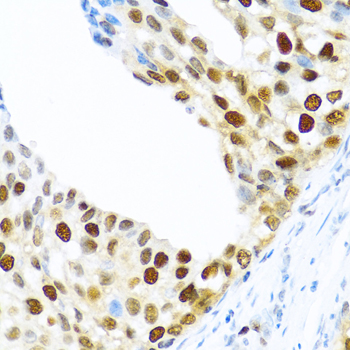 Immunohistochemistry - KHDRBS2 Polyclonal Antibody 