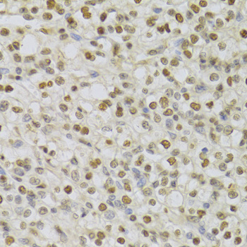 Immunohistochemistry - HDGF Polyclonal Antibody 