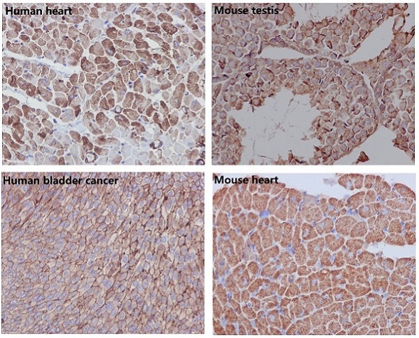 Immunohistochemical analysis of paraffin-embedded (1) Human heart; (2) Mouse testis; (3) Human bladder cancer; (4) Mouse heart, using beta Actin Antibody.