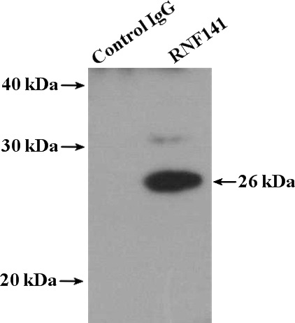 IP Result of anti-RNF141 (IP:Catalog No:114741, 4ug; Detection:Catalog No:114741 1:300) with mouse testis tissue lysate 4000ug.