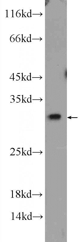 C6 cells were subjected to SDS PAGE followed by western blot with Catalog No:117105(Bcl-xL Antibody) at dilution of 1:1000