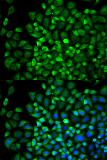 Immunofluorescence - ANGPTL4 Polyclonal Antibody 