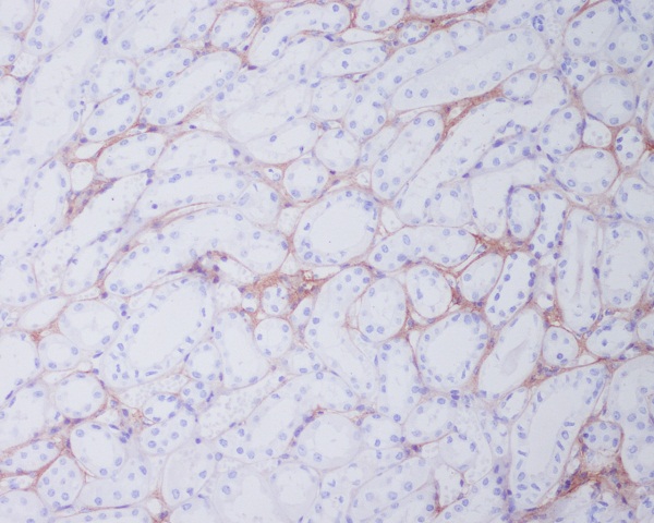 Immunohistochemical analysis of paraffin-embedded human kidney, using Collagen I Antibody.