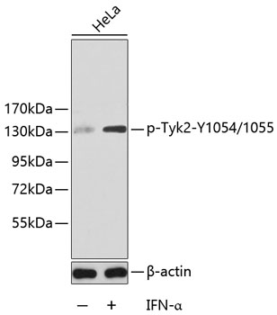Western blot - Phospho-Tyk2-Y1054/1055 pAb 