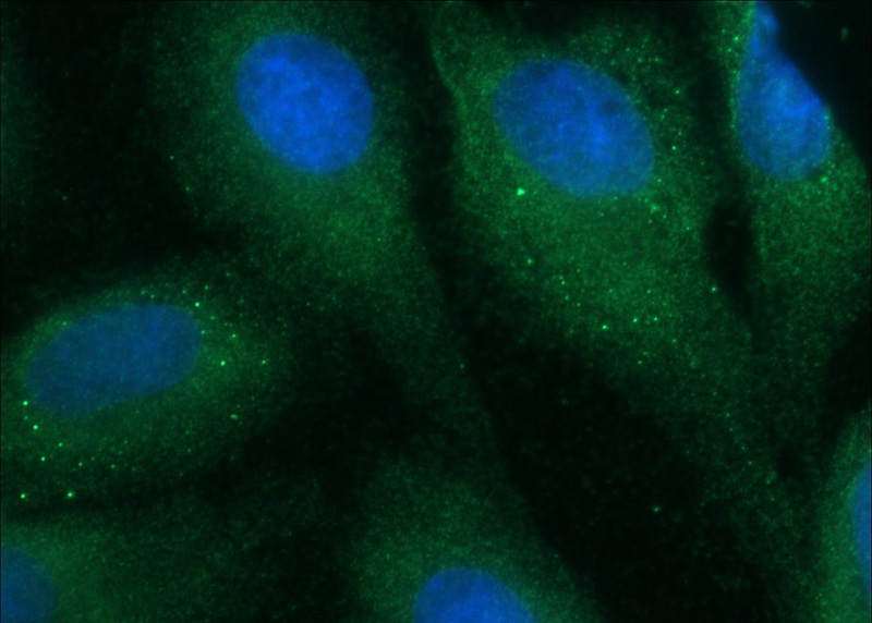 Immunofluorescent analysis of MDCK cells using Catalog No:109978(DISC1-long-specific Antibody) at dilution of 1:50 and Alexa Fluor 488-congugated AffiniPure Goat Anti-Rabbit IgG(H+L)