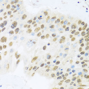 Immunohistochemistry - ZBTB17 Polyclonal Antibody 