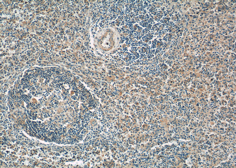 Immunohistochemistry of paraffin-embedded human spleen tissue slide using Catalog No:107488(SELP Antibody) at dilution of 1:50 (under 10x lens)