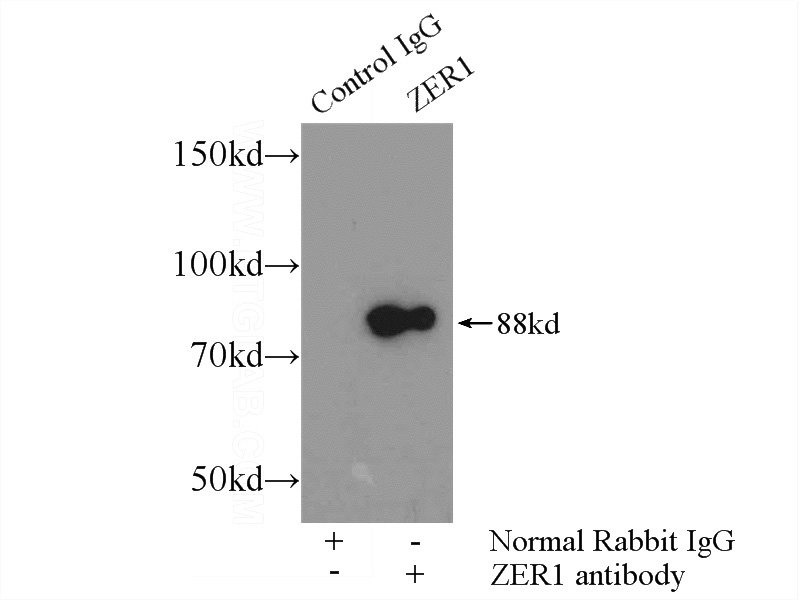 IP Result of anti-ZER1 (IP:Catalog No:117038, 3ug; Detection:Catalog No:117038 1:300) with mouse testis tissue lysate 4000ug.
