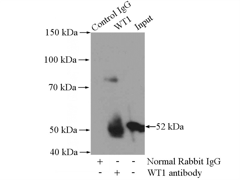 IP Result of anti-WT1 (IP:Catalog No:116973, 4ug; Detection:Catalog No:116973 1:1000) with mouse kidney tissue lysate 4000ug.