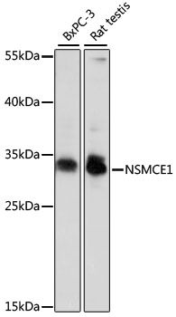 Western blot - NSMCE1 Polyclonal Antibody 