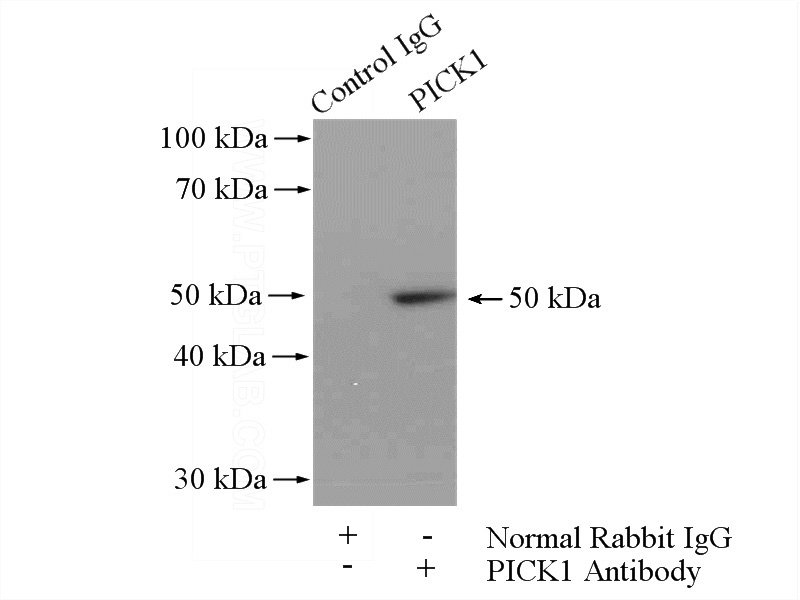 IP Result of anti-PICK1 (IP:Catalog No:113886, 4ug; Detection:Catalog No:113886 1:500) with mouse brain tissue lysate 4400ug.