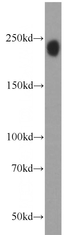 HL-60 cells were subjected to SDS PAGE followed by western blot with Catalog No:115953(TET2 antibody) at dilution of 1:500