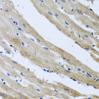 Immunohistochemistry - ST8SIA2 Polyclonal Antibody 