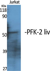 Fig1:; Western Blot analysis of various cells using PFK-2 liv Polyclonal Antibody