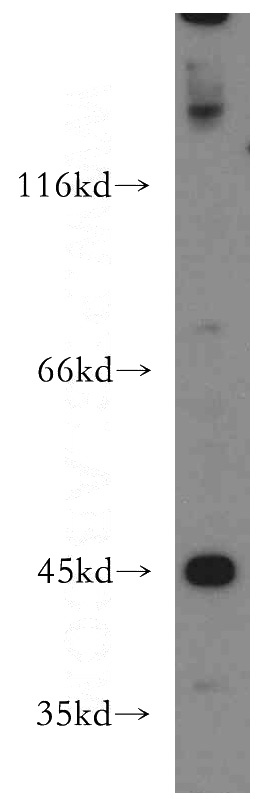 SH-SY5Y cells were subjected to SDS PAGE followed by western blot with Catalog No:112072(KISS1R-Specific antibody) at dilution of 1:400