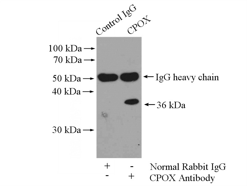 IP Result of anti-CPOX (IP:Catalog No:109460, 4ug; Detection:Catalog No:109460 1:500) with HepG2 cells lysate 2400ug.