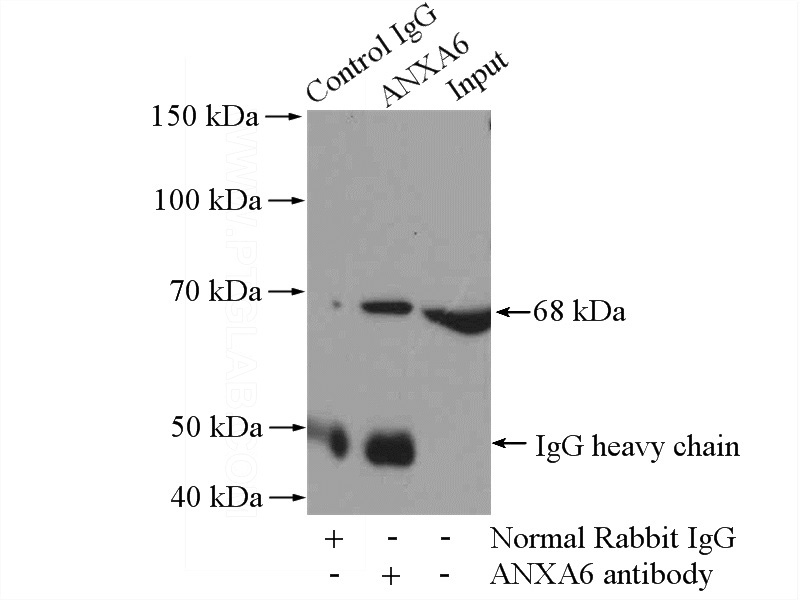 IP Result of anti-ANXA6 (IP:Catalog No:108097, 4ug; Detection:Catalog No:108097 1:500) with mouse kidney tissue lysate 4000ug.