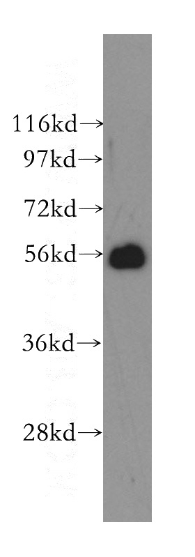 human brain tissue were subjected to SDS PAGE followed by western blot with Catalog No:108331(ATL1 antibody) at dilution of 1:500