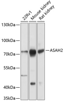 Western blot - ASAH2 Polyclonal Antibody 