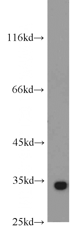 mouse brain tissue were subjected to SDS PAGE followed by western blot with Catalog No:114844(RPS3 antibody) at dilution of 1:1000