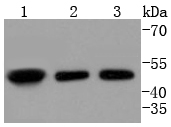 Fig1:; Western blot analysis of E2F2 on different lysates. Proteins were transferred to a PVDF membrane and blocked with 5% BSA in PBS for 1 hour at room temperature. The primary antibody ( 1/500) was used in 5% BSA at room temperature for 2 hours. Goat Anti-Rabbit IgG - HRP Secondary Antibody (HA1001) at 1:200,000 dilution was used for 1 hour at room temperature.; Positive control:; Lane 1: K562 cell lysate; Lane 2: 293T cell lysate; Lane 3: HepG2 cell lysate